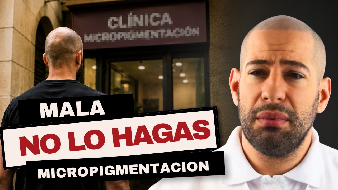 Me hicieron la micropigmentación capilar en un lugar extraño… la arreglé y me injerté yo mismo​😱​