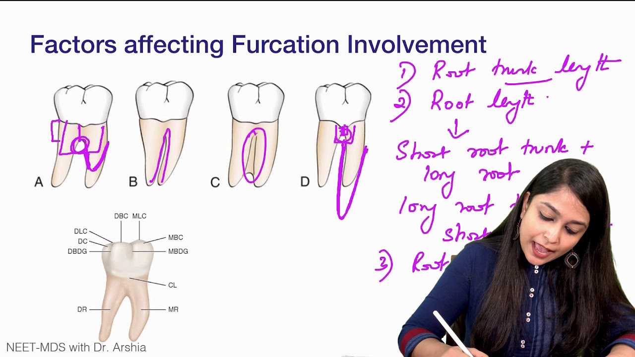 Furcation NEET MDS Lecture