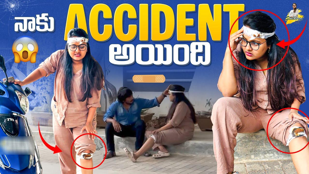 నాకు Acci*dent అయింది || Yadamma Raju | Stellaraj 777 #stellaraj777