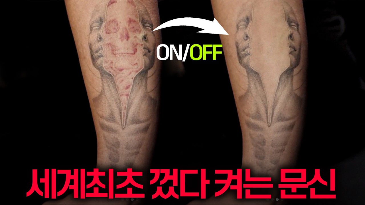 이제 의사가 아니어도 문신을 없앨 수 있다고?!