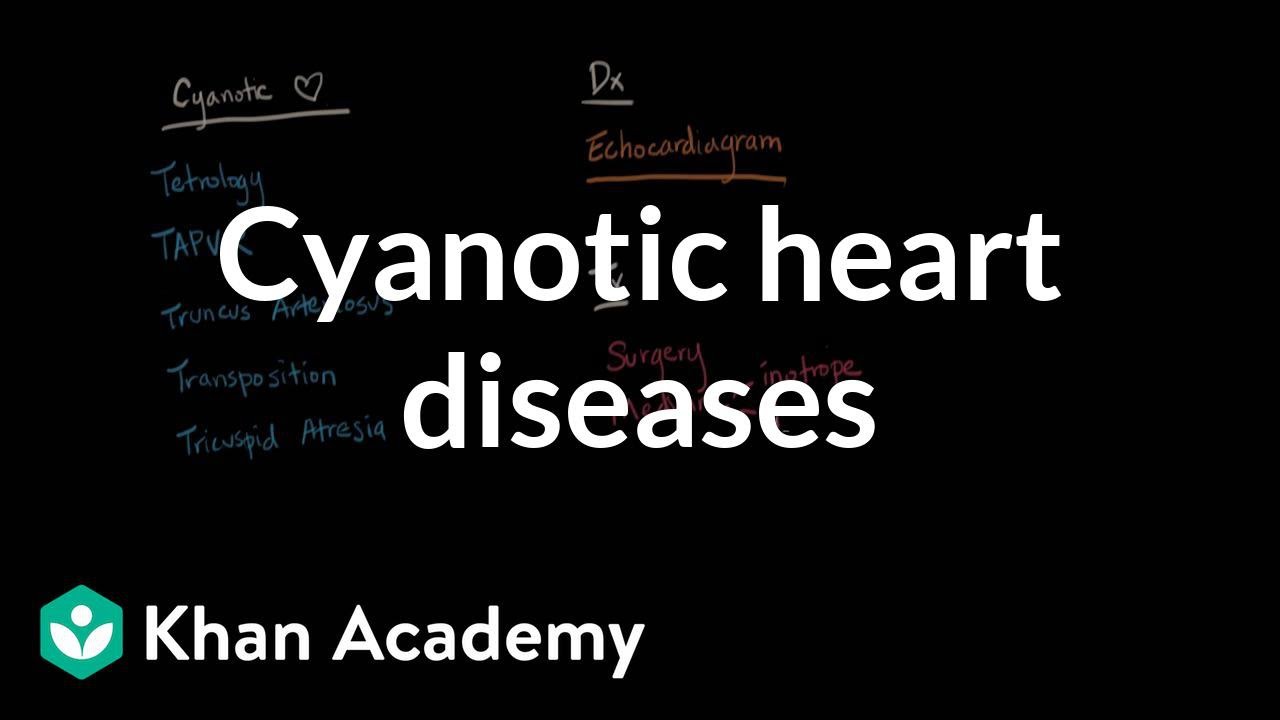 Cyanotic heart diseases - Diagnosis and treatment | NCLEX-RN | Khan Academy