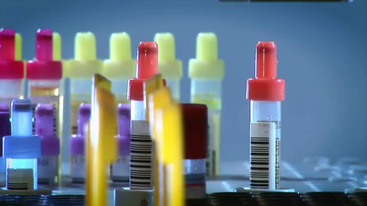 Sarstedt Laboratory Automation