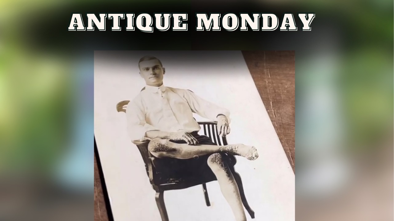 Антикварный понедельник — Человек в слоновьей шкуре — RPPC