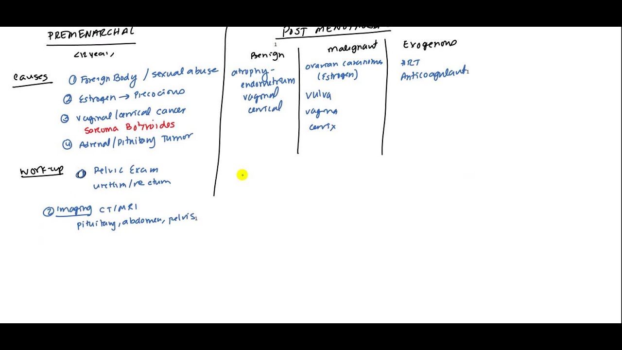 Abnormal Uterine Bleeding for USMLE