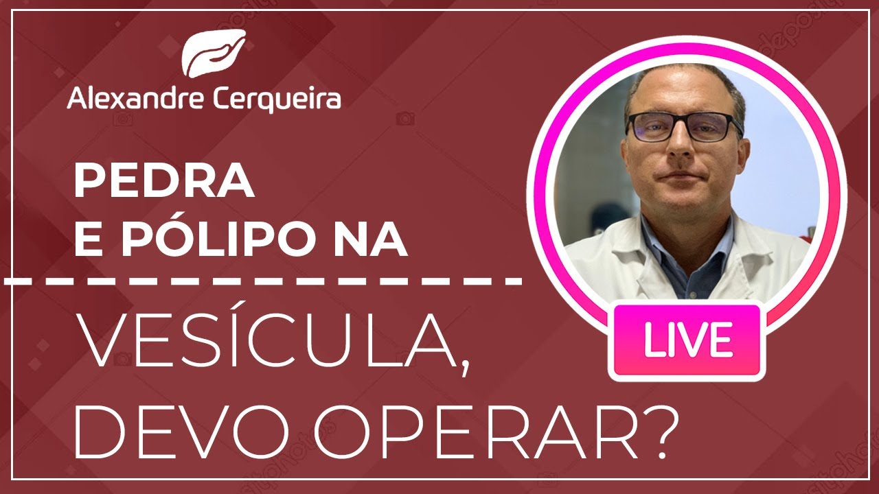 Pedra e pólipo na vesícula, devo operar?