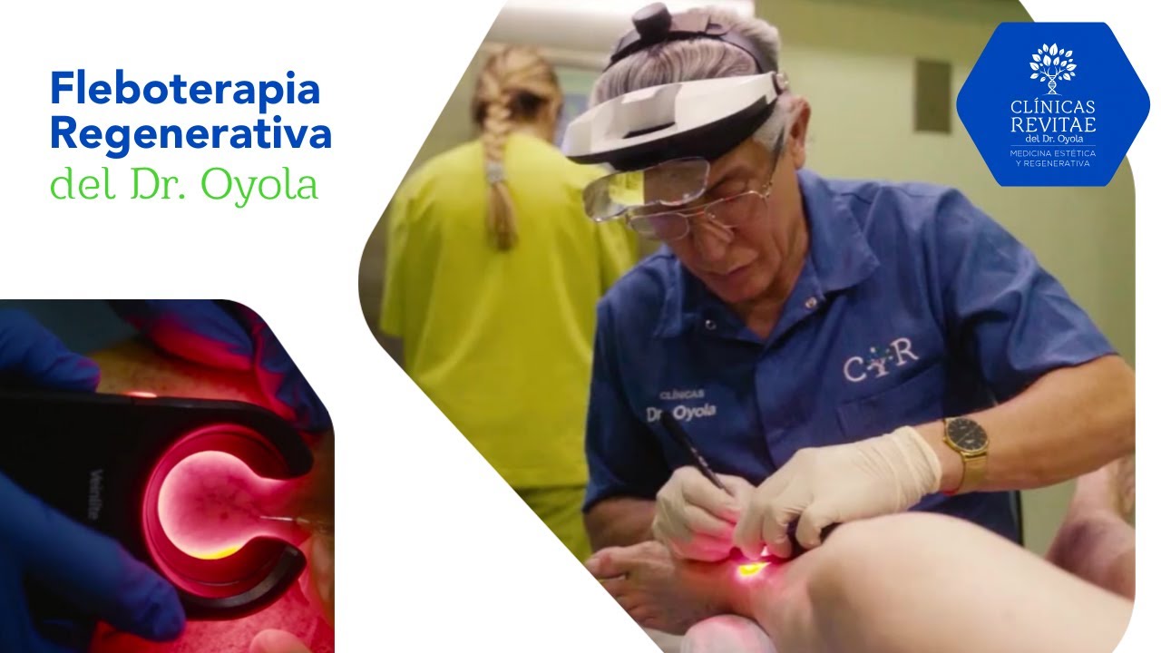 Solución a las varices. Fleboterapia regenerativa del Dr. Oyola.