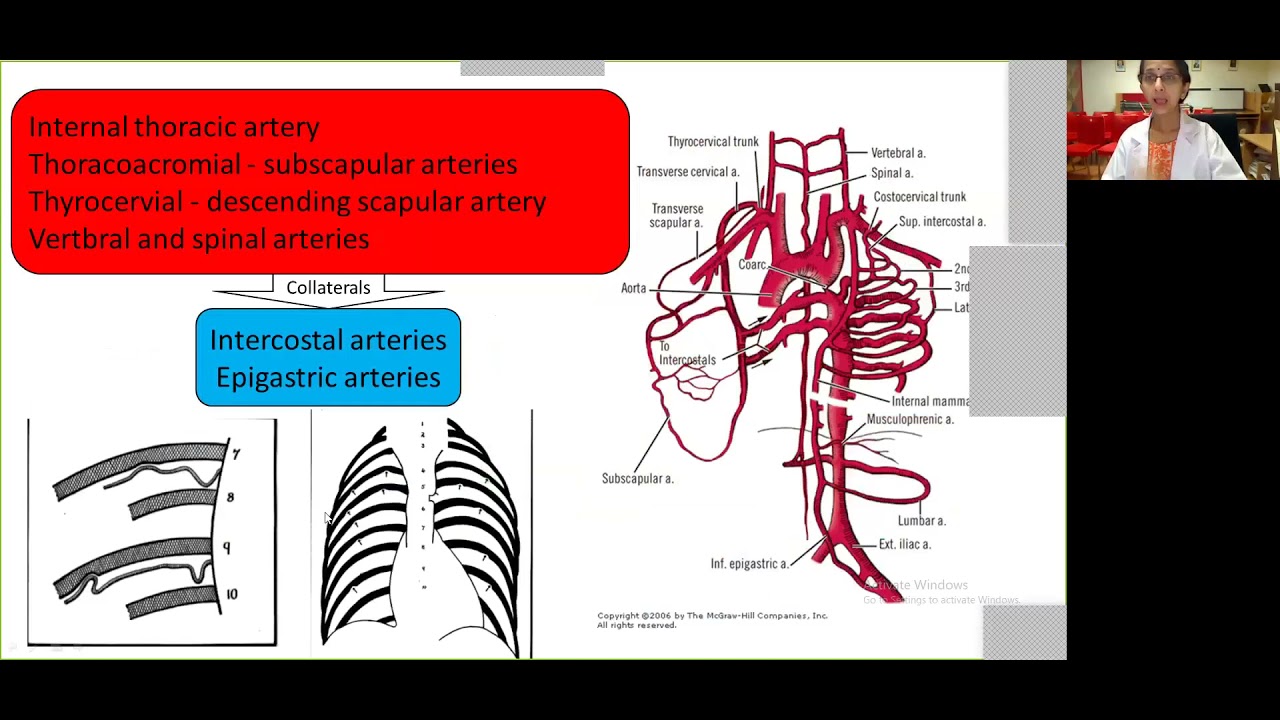 Coarctation signs, symptoms, history, investigations by Dr Sejal