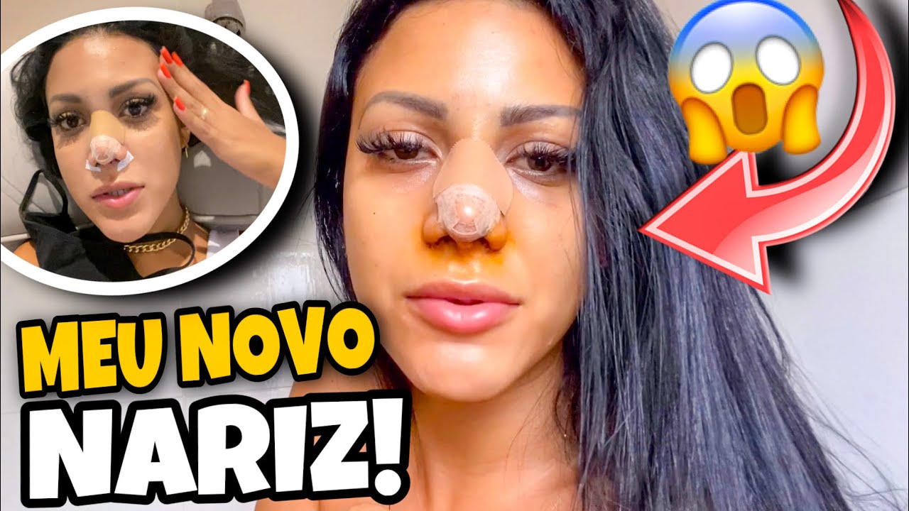 OLHA COMO MEU NARIZ FICOU!! *mostrei tudo* 😱