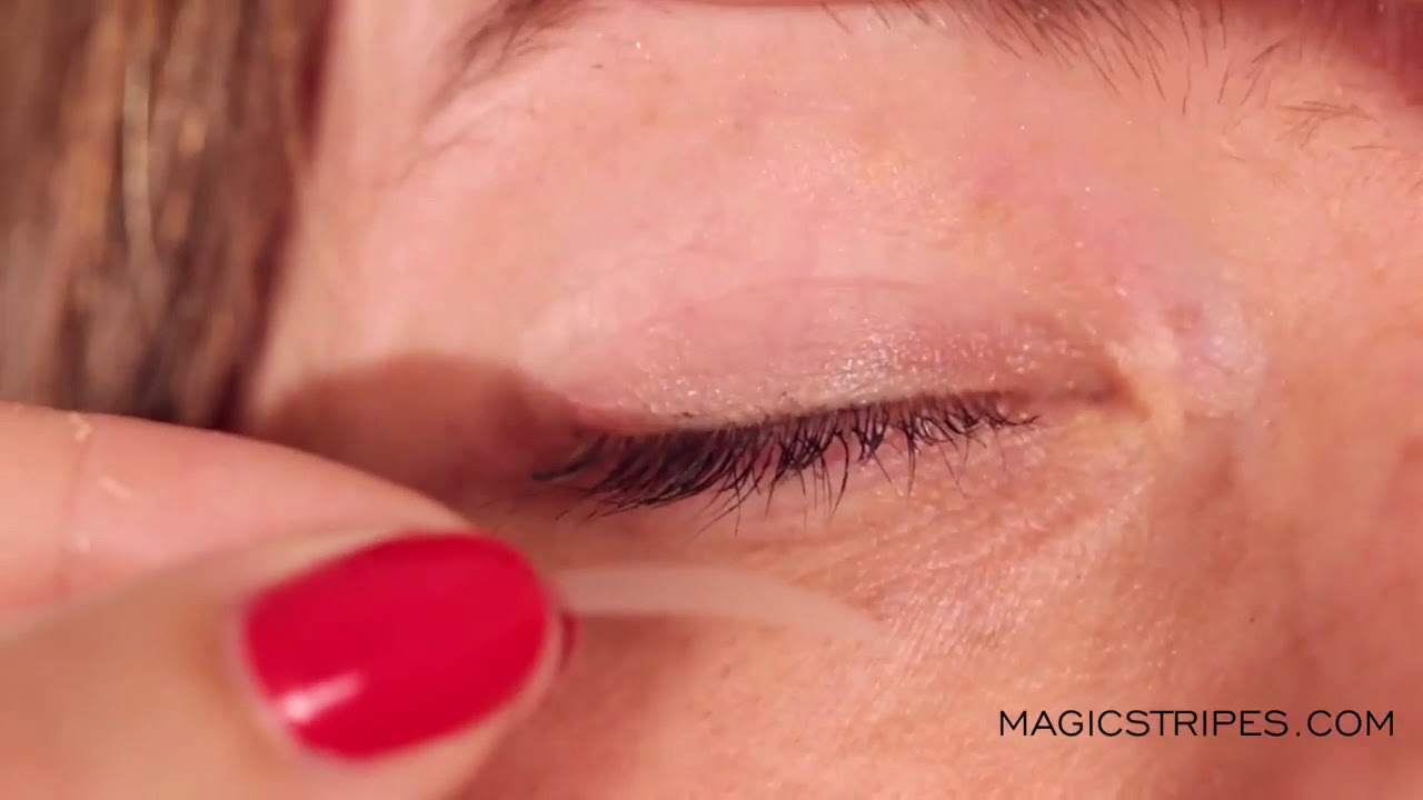 Magicstripes Eyelid Lifting Strips