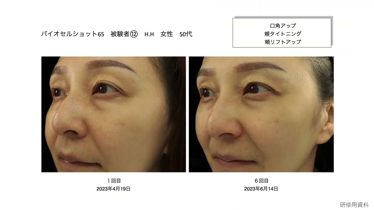 【チャプター3】BCS65顧問等との取り組み・医療提携サロン制度について