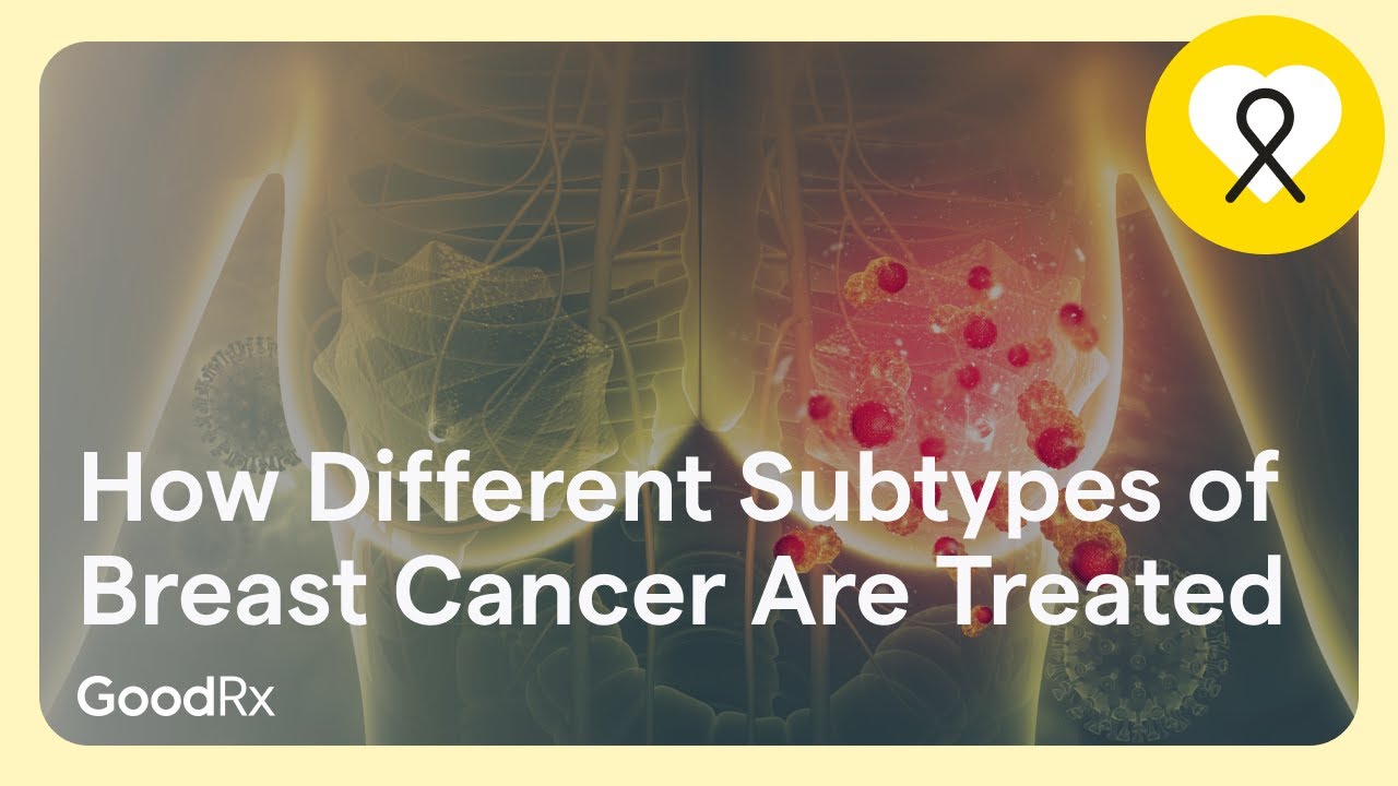 How Different Subtypes of Breast Cancer Are Treated | GoodRx