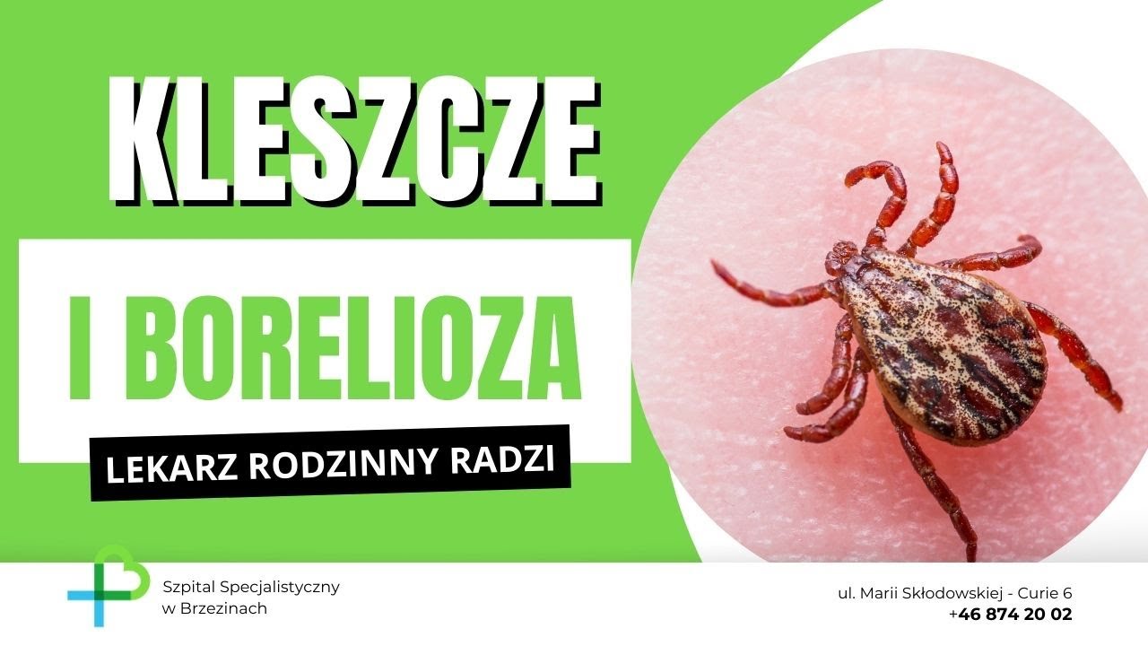 Borelioza - LEKARZ RODZINNY RADZI