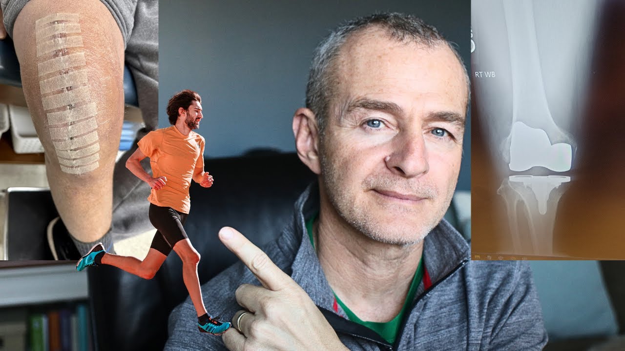 Can You 🏃 RUN 🏃 After Total Knee Replacement?