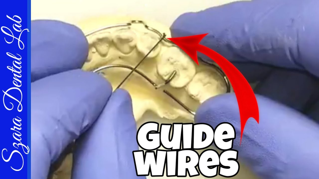 How to add Guide Wires onto Retainers by Szara Dental