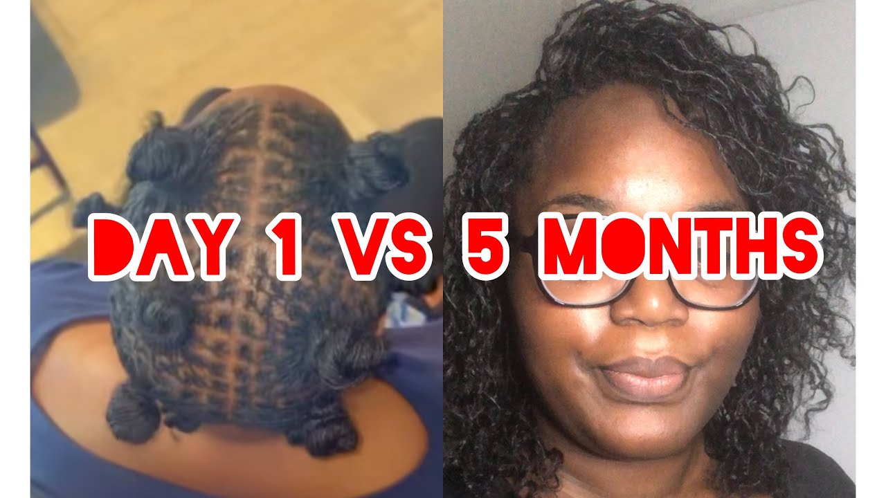 5 month micro loc update| protective styling over micro locs! 