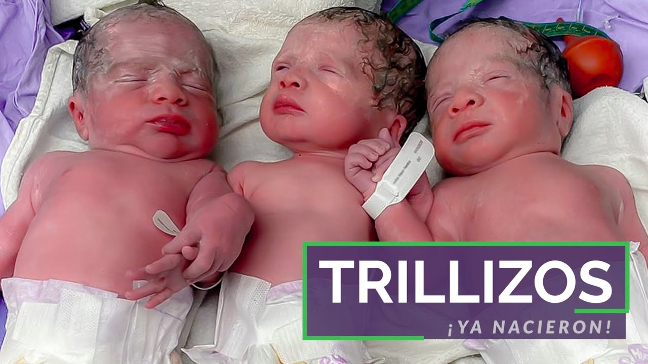 ¡Ya nacieron los trillizos!