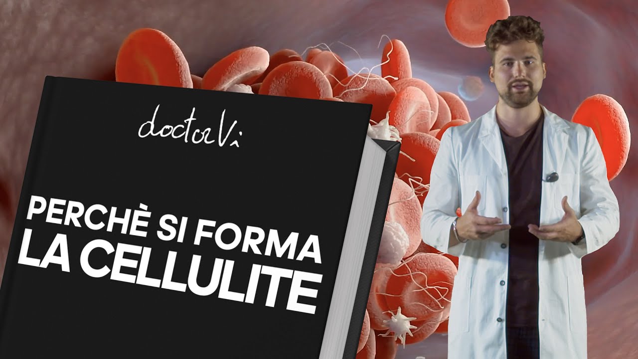 Perchè si forma la cellulite?