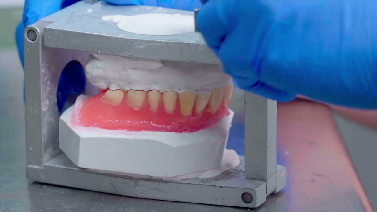 Mucopren® soft Indirecte techniek