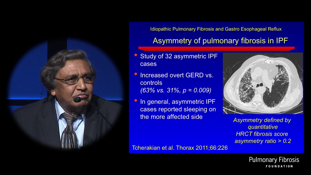 Gastroesophageal Reflux Disease (GERD) in ILD | Ganesh Raghu, MD