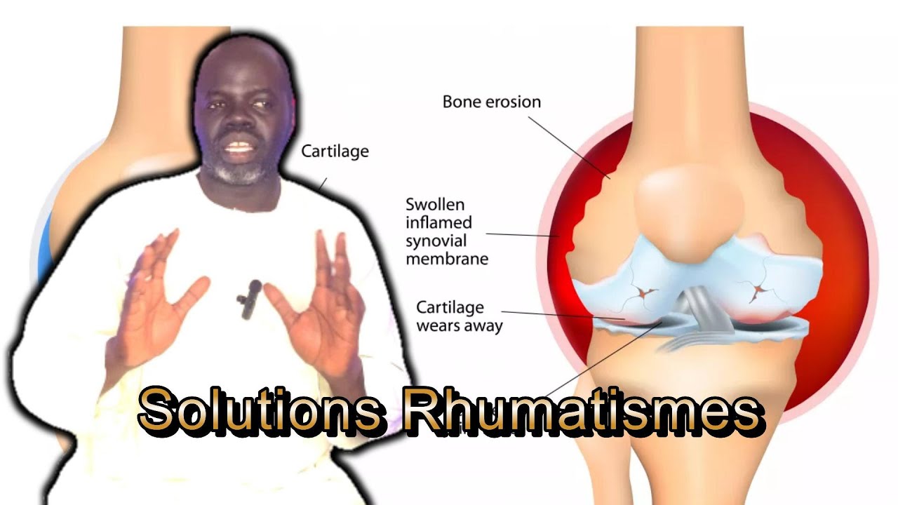 #2 - Rhumatisme: Prévention, Solutions et Remèdes - Pr Ousmane Ndiaye - SAMA XALAAT TV