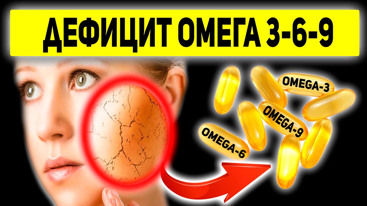 Все Симптомы Нехватки Омега-3. Отличия Омега 3-6-9. Продукты, богатые жирными кислотами