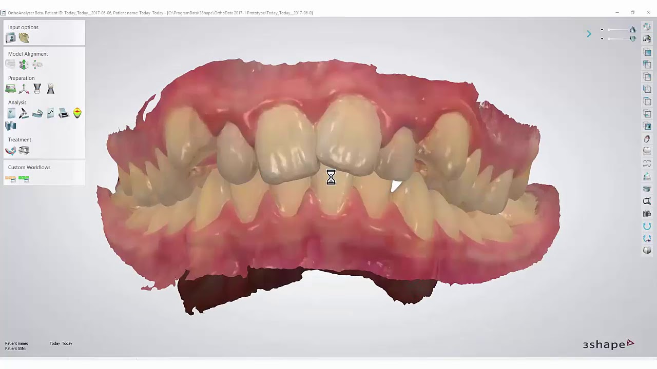 Learn how to import files in Ortho Analyzer