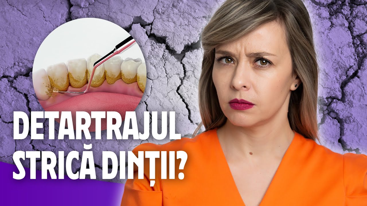 DETARTRAJ | DA SAU NU?