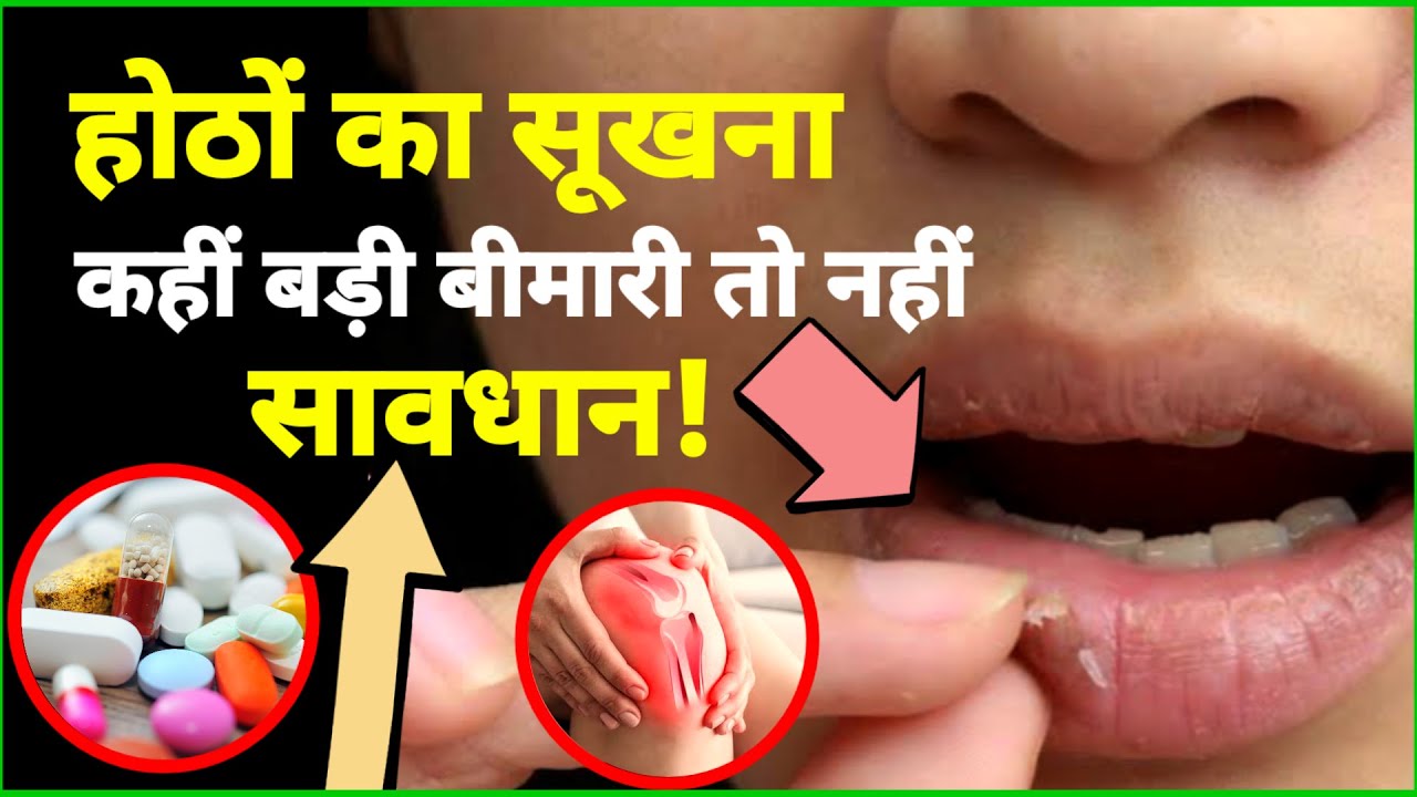 होठों का सूखना कहीं बड़ी बीमारी तो नहीं? Dry lips are not a big disease?