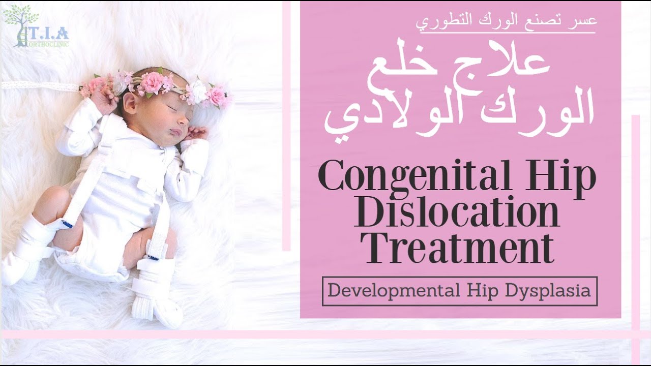 علاج خلع الورك الولادي congenital hip dislocation treatment (subtitled)