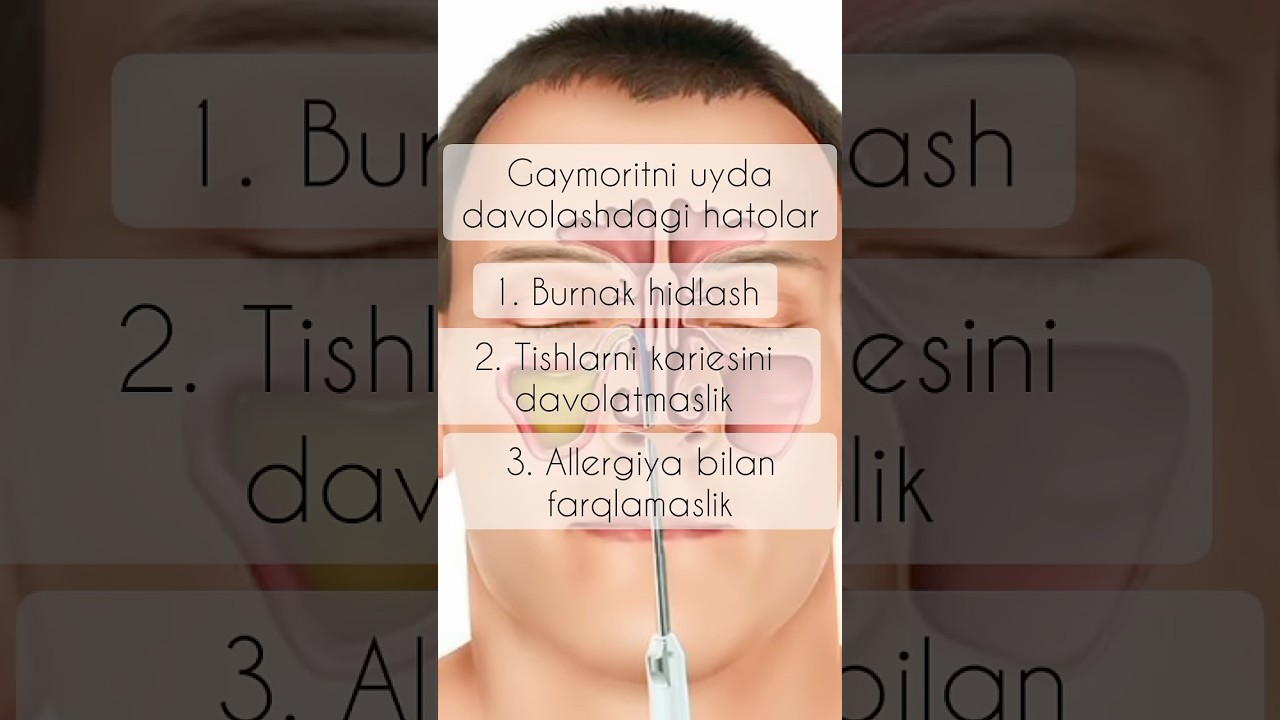 Gaymoritni davolashdagi qilinadigan hatolar