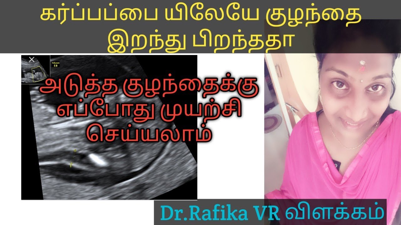 கர்ப்பப்பையிலேயே குழந்தை இறந்து பிறந்ததா | still birth | intrauterine death|IUD|still birth in tamil