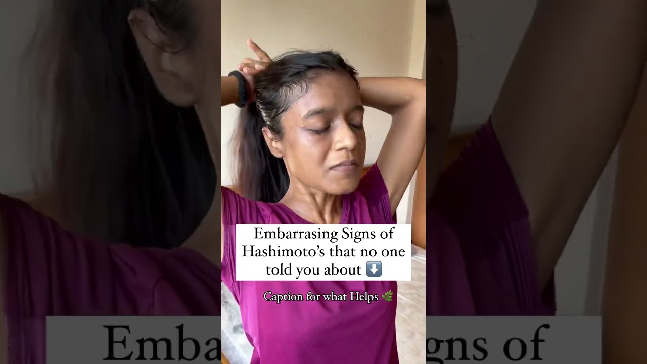 Signs of Hashimoto’s Thyroiditis 🦠