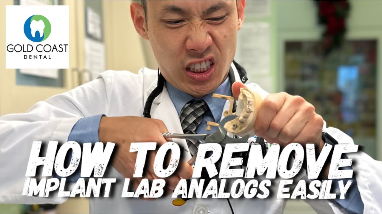 How to Remove Implant Lab Analogs Easily
