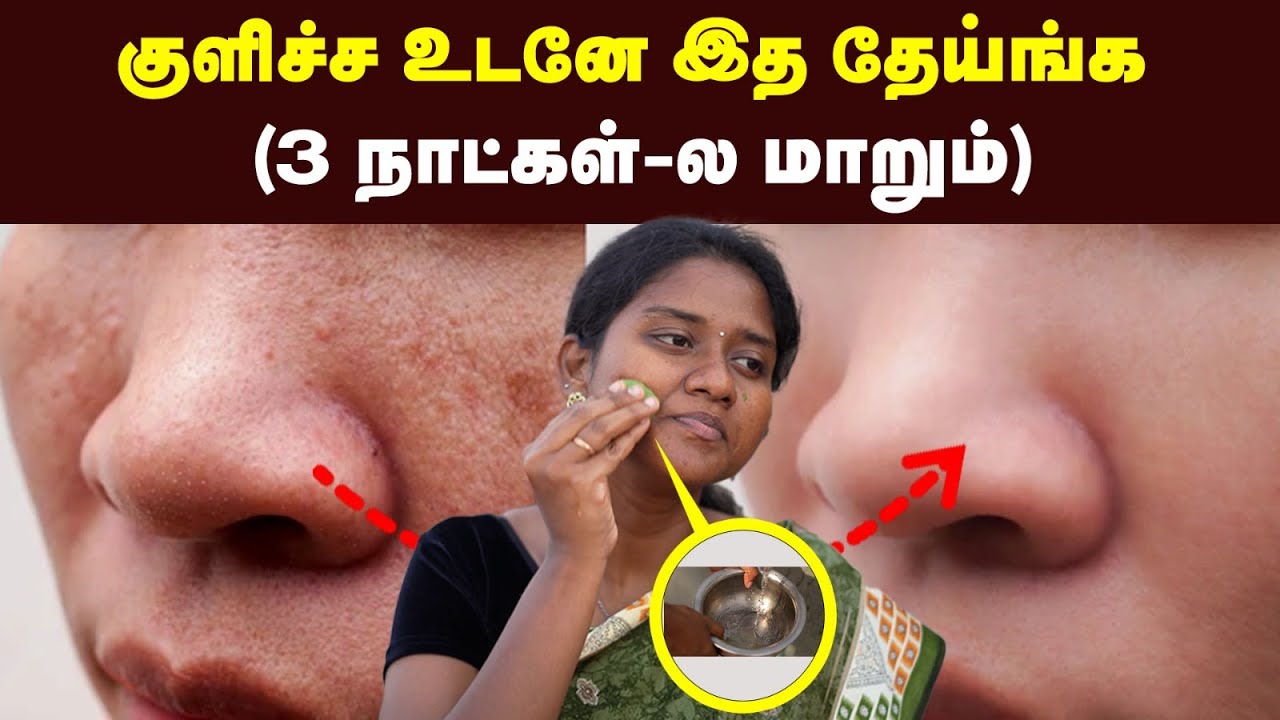 Winter Skin Care Secrets to Get GLOWING Skin! | சருமம் பளபள-ன்னு இருக்க இத பண்ணுங்க!