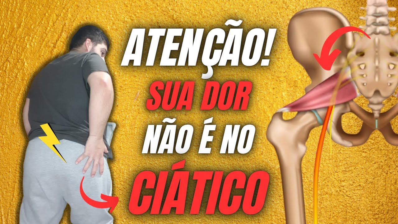 SUA DOR NÃO É NO NERVO CIÁTICO. FAÇA ISSO E ALIVIE SUAS DORES