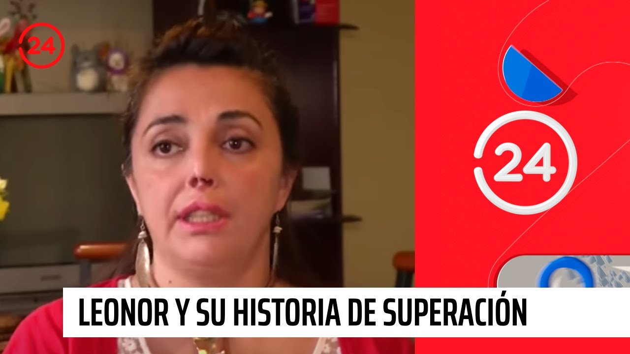 La profesora que doblegó a la muerte tras ser amputada de piernas y manos | 24 Horas TVN Chile