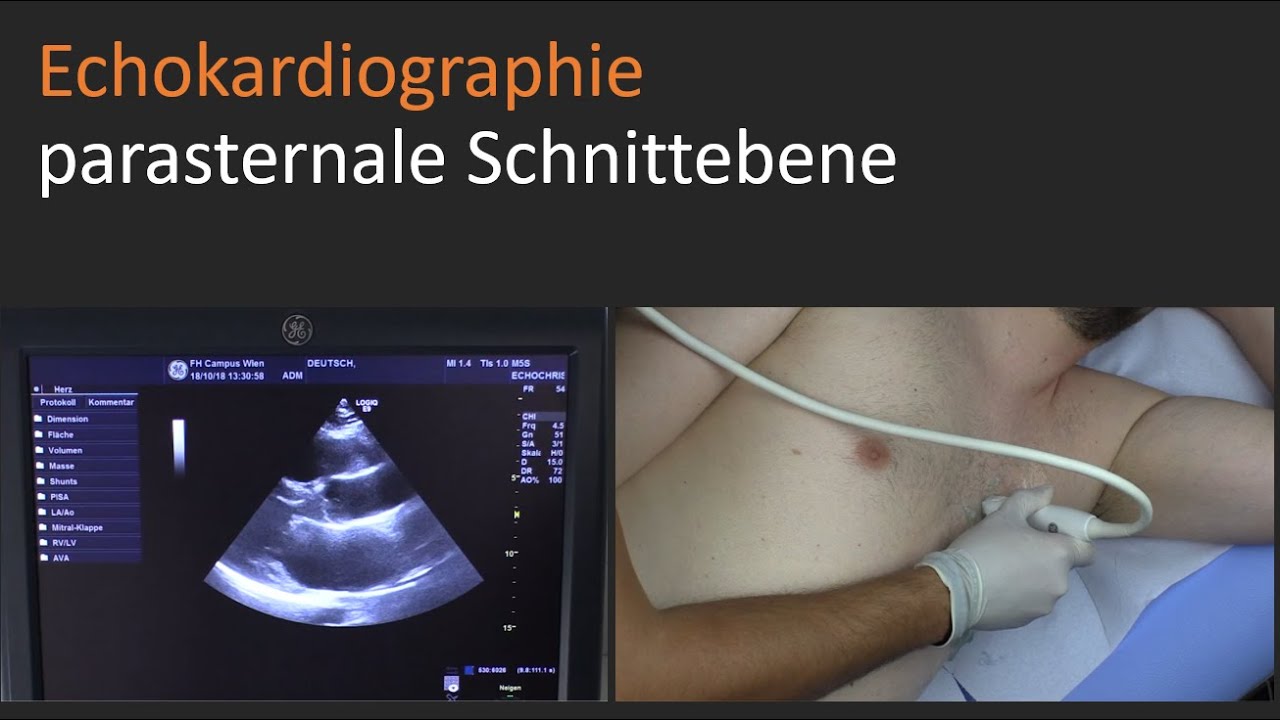 parasternale Schnittebene - Echokardiographie