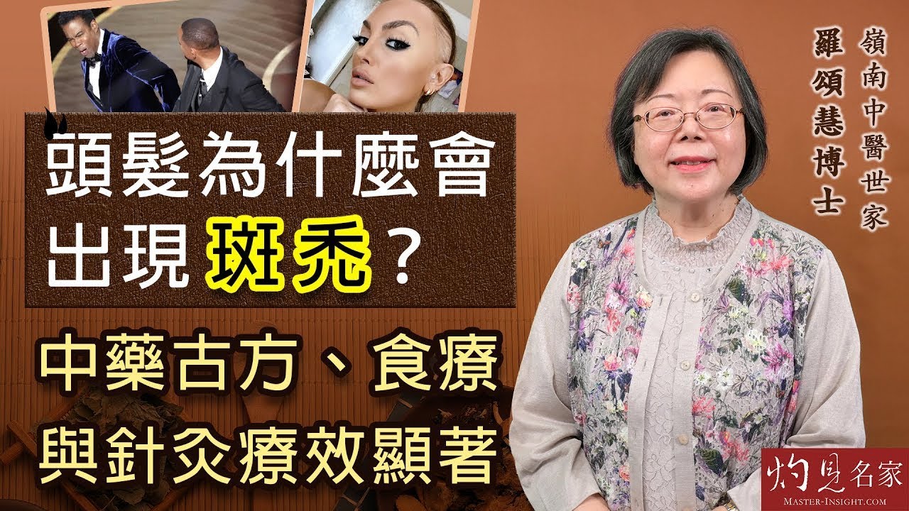 嶺南中醫世家羅頌慧博士：頭髮為什麼會出現斑禿？中藥古方、食療與針灸療效顯著 《大醫精誠》（2023-06-08）