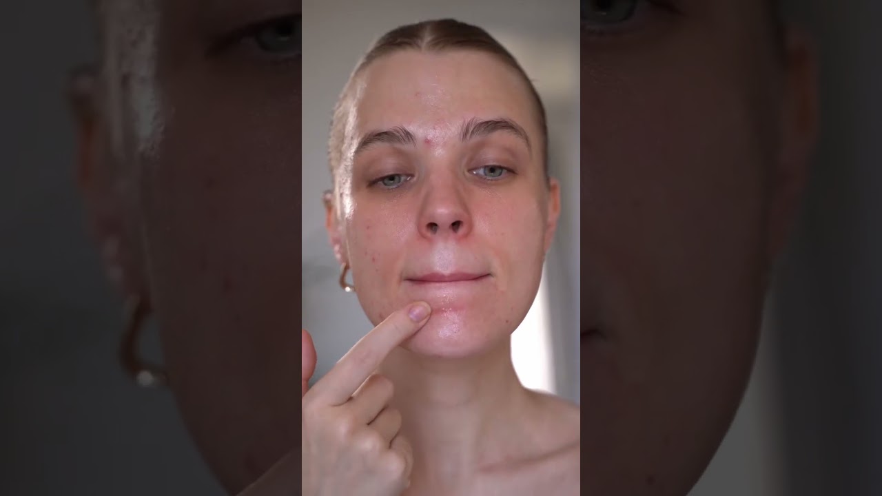 8 недель на третиноине ☁️ моя кожа чувствует себя ужасно 😬