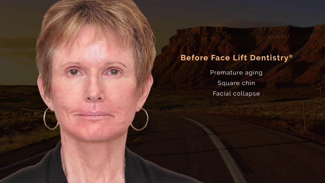 JawTrac&reg; Jaw Alignment and Bite Correction Reverses Facial Collapse