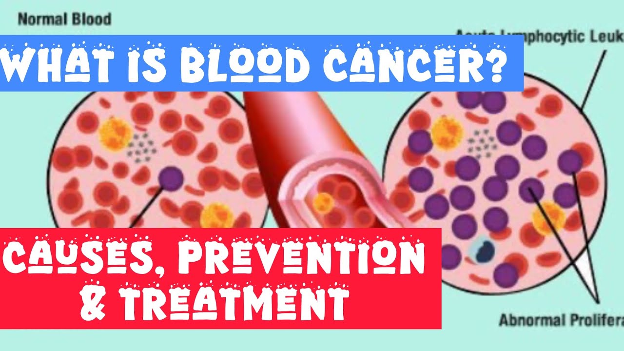 Will you have Cancer?| Want to know? | डर को मारो गोली और करो फुल फुल मस्ती 