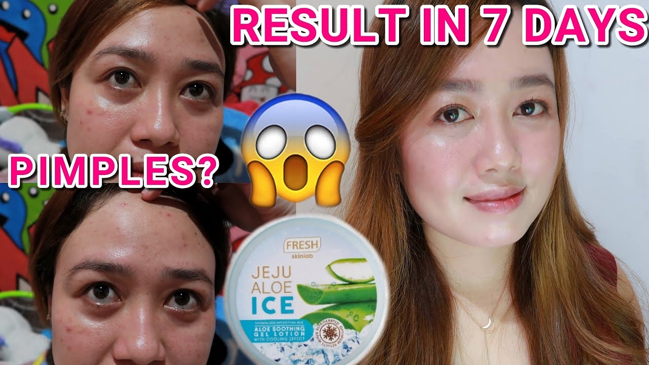 FRESH SKINLAB JEJU ALOE ICE RESULT IN 7 DAYS | UPDATE REVIEW | MAY NA DISCOVER AKO | PART III