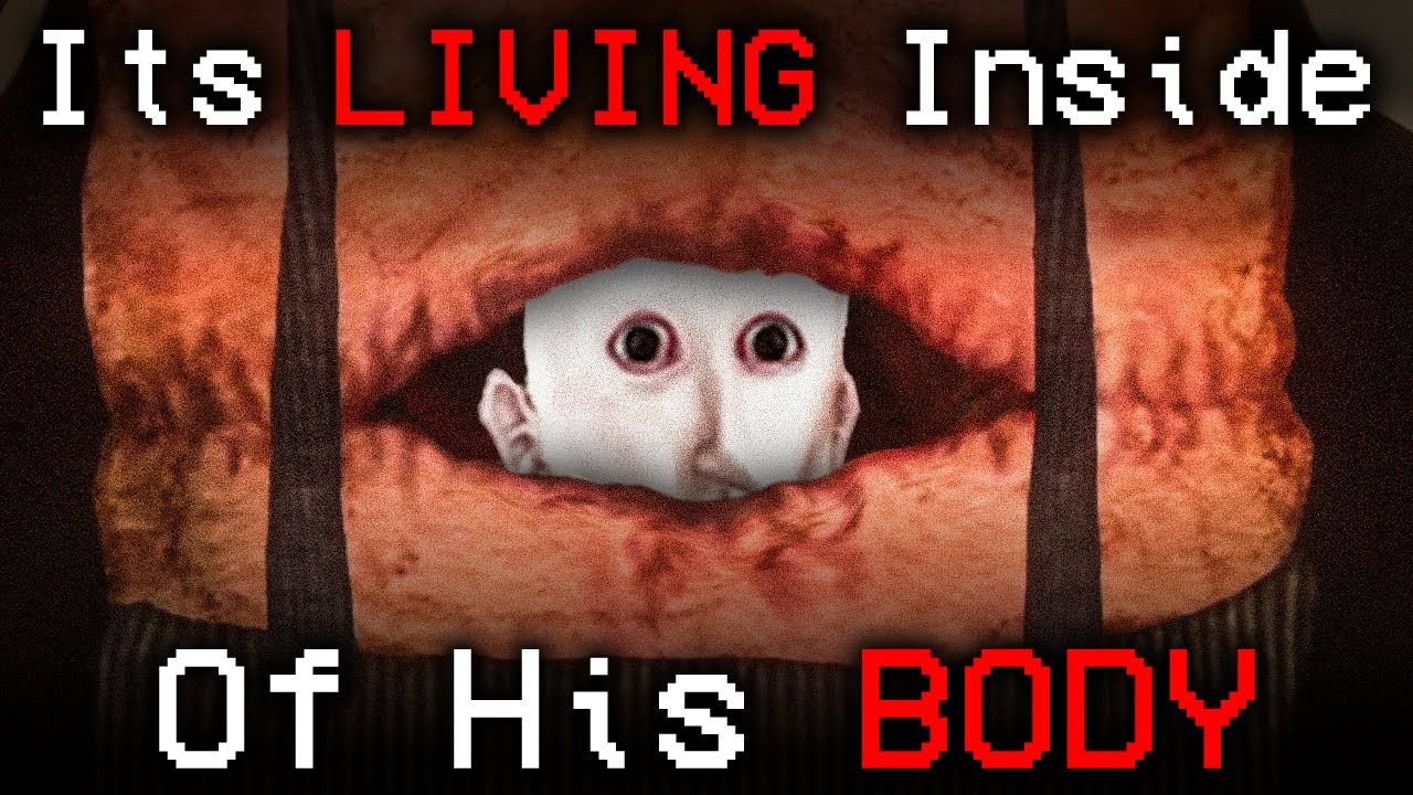 The PARASITE Torturing Him From The INSIDE | Doctor Nowhere