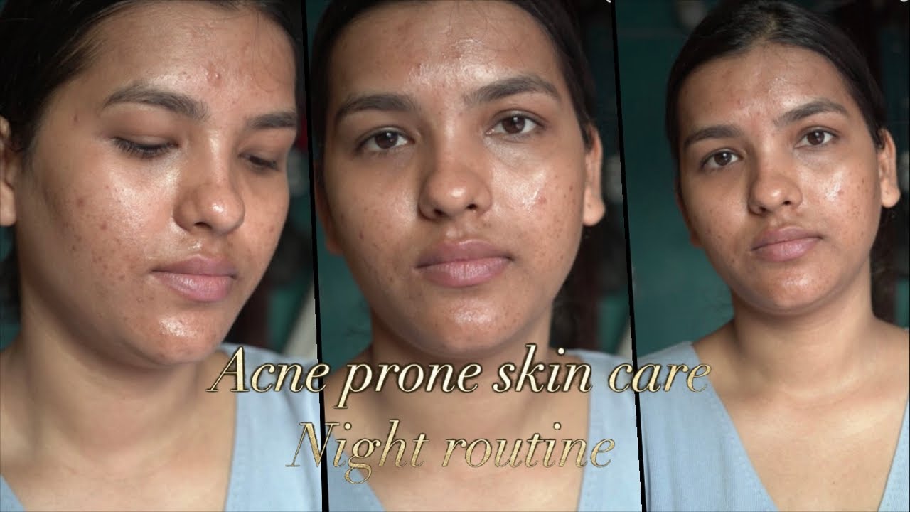 Desi Dimple Diaries  is live night skin care and products review