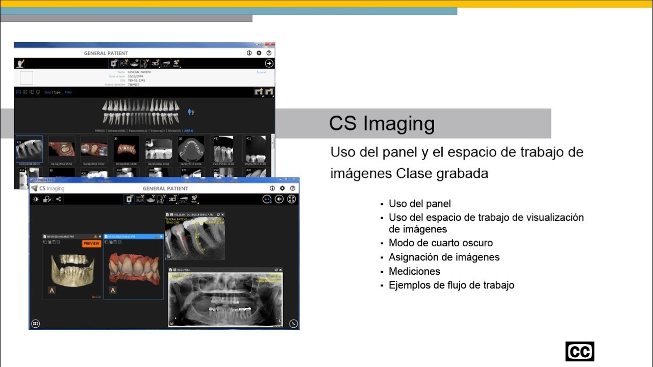 CS Imaging: Uso del Panel y el Espacio de Trabajo de Imágenes