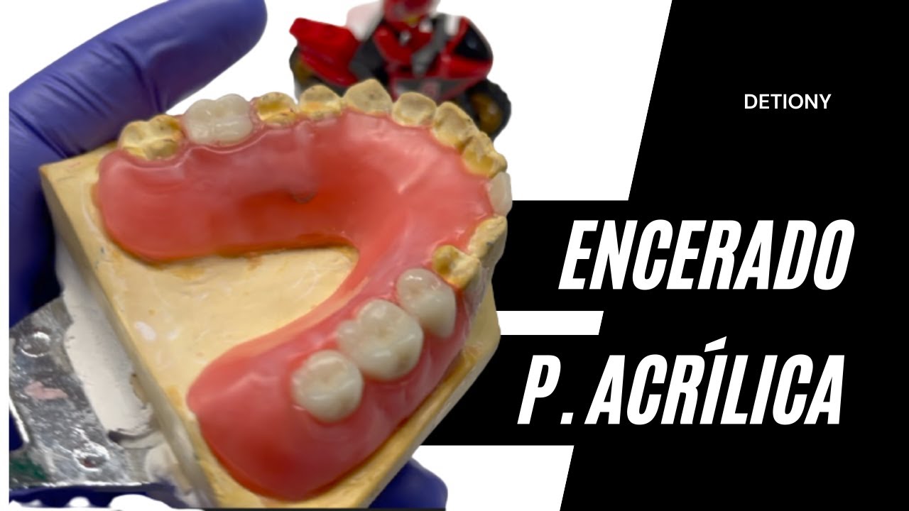 Encerado Dental Paso a Paso