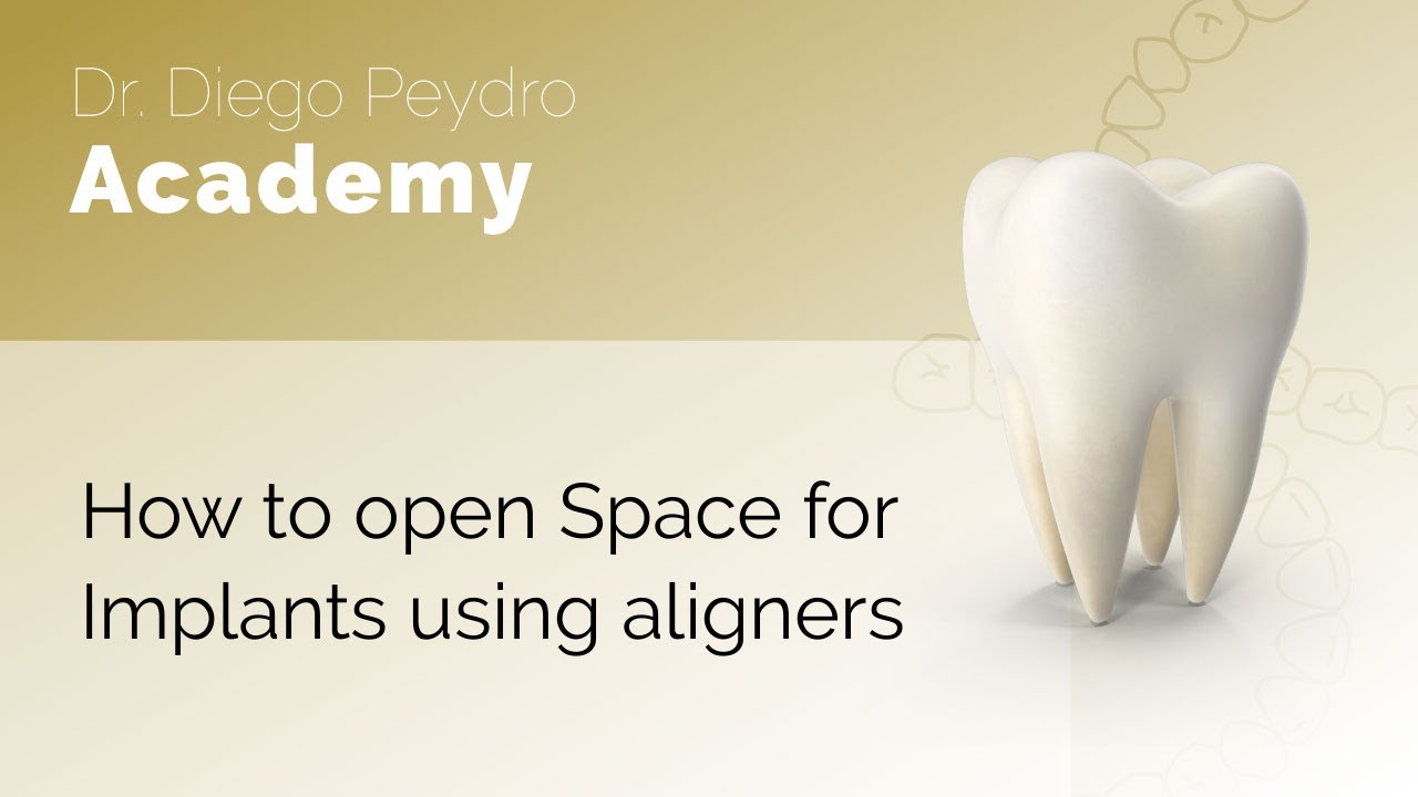 How to open Space for Implants using aligners