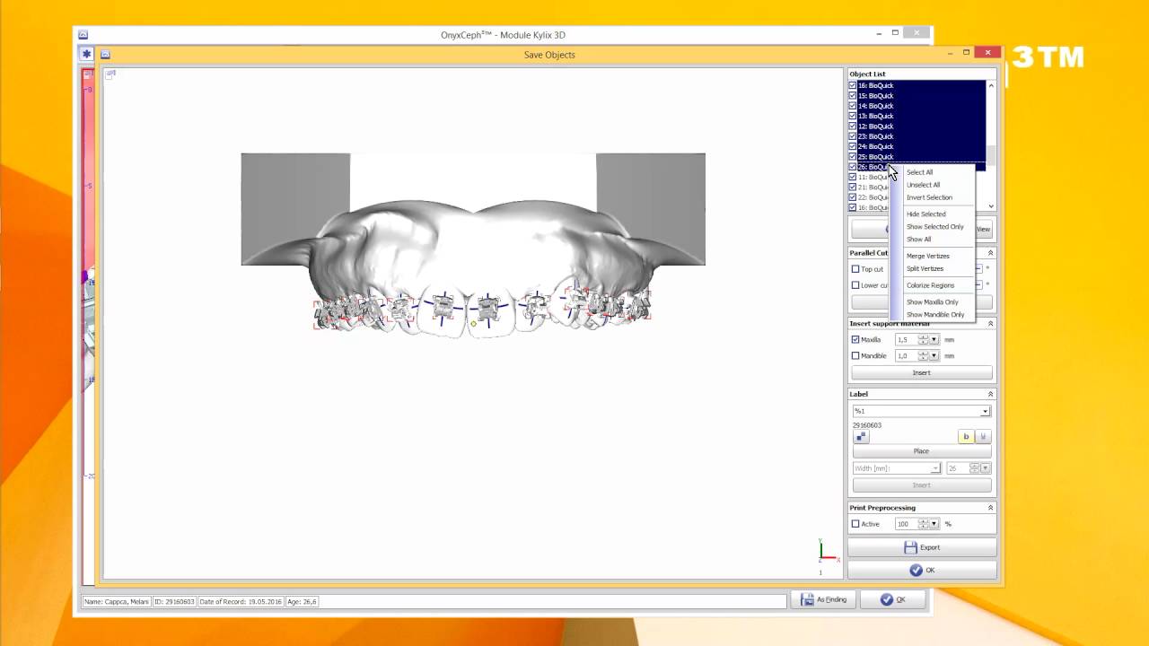 OnyxCeph&sup3;&trade; Module Kylix 3D