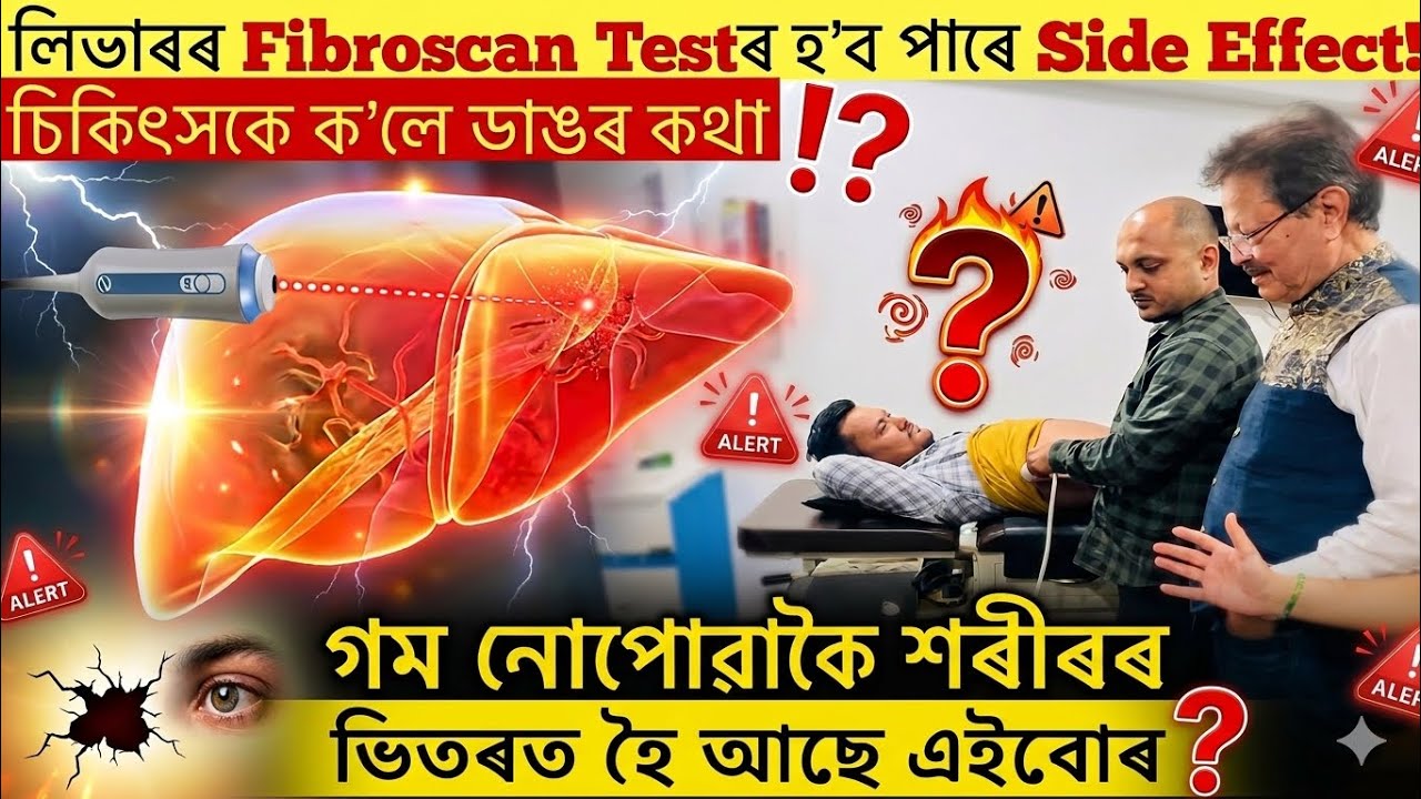 কি কি ৰোগীয়ে Fibroscan Test কৰিব নালাগে?