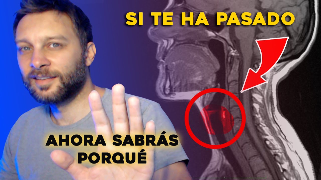 Los peores GALLOS al CANTAR y porqué aparecen